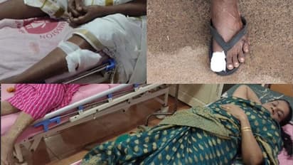 'രോമം കൊഴിഞ്ഞ രൂപം' വഴിയിൽ നടന്നവരെയും വീട്ടിലിരുന്നവരെയും വിട്ടില്ല, ആറോളം പേരെ ഓടിനടന്ന് കടിച്ച് തെരുവുനായ 