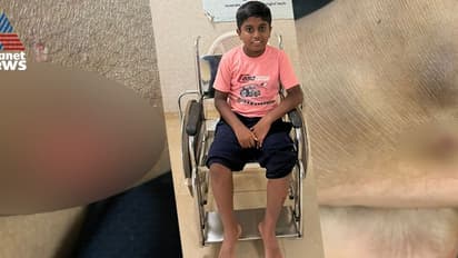 മദ്രസയിൽ പോയി വരവേ 12 വയസുകാരനെ തെരുവുനായ്ക്കൾ ഓടിച്ചിട്ട് കടിച്ചു, ഗുരുതര പരിക്ക്; രക്ഷകനായി ബൈക്ക് യാത്രികൻ