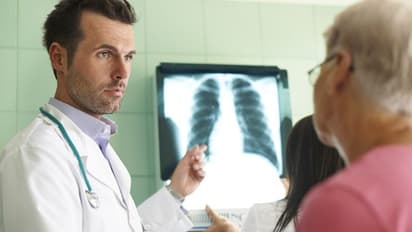 World Lung Cancer Day: सिगरेट का छल्ला, टैलकम पाउडर क्या होते हैं लंग कैंसर के कारण?