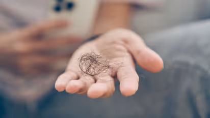 ഈ വിറ്റാമിനുകളുടെ കുറവ് ഉണ്ടെങ്കിൽ മുടികൊഴിച്ചിലുണ്ടാകാം