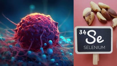 ക്യാന്സര് സാധ്യത കുറയ്ക്കാന് സഹായിക്കുന്ന സെലീനിയം അടങ്ങിയ ഒമ്പത് ഭക്ഷണങ്ങള്