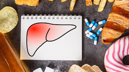 ഫാറ്റി ലിവർ രോഗത്തെ തടയാന് നിർബന്ധമായും ഒഴിവാക്കേണ്ട മൂന്ന് പാനീയങ്ങള്