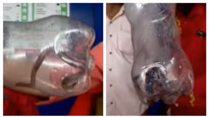 മകളുമായി സർക്കാർ ആശുപത്രിയിലെത്തിയ അമ്മയ്ക്ക് പാമ്പുകടിയേറ്റു