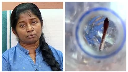 'പാമ്പുകടിയേറ്റിട്ടില്ല, സംശയത്തിന്‍റെ പേരില്‍ റഫര്‍ ചെയ്തത് ശരിയായില്ല': നിഷേധിച്ച് ആരോ​ഗ്യവകുപ്പ് ഡയറക്ടർ