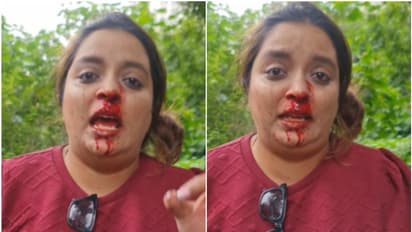  WATCH: Video of Pune woman punched in face in road rage incident goes viral
