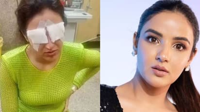 'ഒന്നും കാണാന് പറ്റുന്നില്ല', ലെൻസ് ധരിച്ചതിനെ തുടർന്ന് കോർണിയ തകരാറിലായി; നടി ജാസ്മിൻ ചികിത്സയിൽ