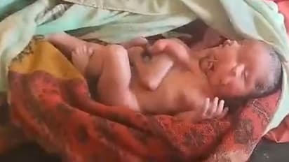 ಎರಡು ದೇಹ ಎರಡು ಮುಖ 4 ಕೈಕಾಲುಗಳಿರುವ ವಿಚಿತ್ರ ಮಗುವಿಗೆ ಜನ್ಮ ನೀಡಿದ ತಾಯಿ