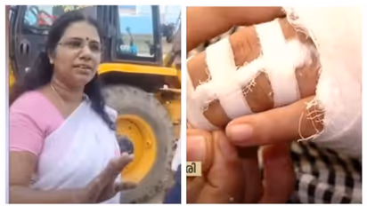 കൊച്ചിയിൽ ഹോട്ടൽ ജീവനക്കാരിയെ മർദിച്ച സംഭവം; കൗൺസിലർ സുനിത ഡിക്സനെതിരെ കേസെടുത്ത് പൊലീസ്