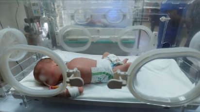 ಯುದ್ಧಪೀಡಿತ ಗಾಜಾದಲ್ಲಿ ಮೃತ ತುಂಬು ಗರ್ಭಿಣಿಗೆ ತಕ್ಷಣವೇ ಸಿಸೇರಿಯನ್ : ಮಗು ಬದುಕಿಸಿದ ವೈದ್ಯರು