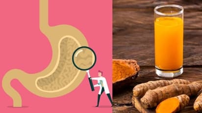 Yogurt to Ghee to Legumes: 10 top nutrient-riched foods for enhancing gut health