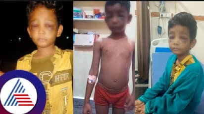 ಪೆನ್ನು ಕದ್ದಿದ್ದಕ್ಕೆ ಬಾಲಕನಿಗೆ ಮನಬಂದಂತೆ ಥಳಿಸಿದ ಗುರೂಜಿ! ಮಗನ ಸ್ಥಿತಿ ಕಂಡು ತಾಯಿ ಆಘಾತ!