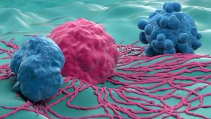 ക്യാന്സര് സാധ്യതയെ കുറയ്ക്കാന് സഹായിക്കും ഈ സുഗന്ധവ്യഞ്ജനങ്ങൾ