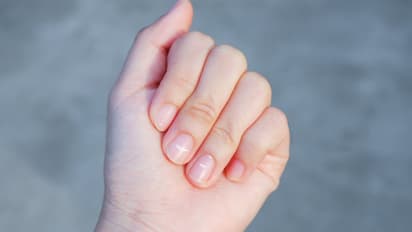 Health Tips: ശരീരത്തിൽ കാത്സ്യം കുറവാണോ? തിരിച്ചറിയാം ഈ ലക്ഷണങ്ങളെ