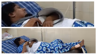 കാട്ടുപന്നിയിടിച്ച് സ്കൂട്ടർ യാത്രക്കാരിയായ നഴ്സിന് ഗുരുതര പരിക്ക്