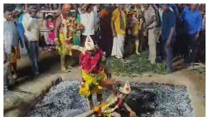 தீக்குழியில் விழுந்த சிறுவன் படுகாயம்; தந்தை இழுத்து சென்றபோது சோகம்