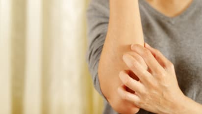 Health Tips: സോറിയാസിസ് രോഗത്തെ എങ്ങനെ തിരിച്ചറിയാം? ലക്ഷണങ്ങള് ഇങ്ങനെ