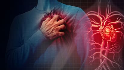 क्या आप जीरो कैलोरी शुगर लेते हैं? सावधान! ब्लड क्लाॅटिंग-हार्ट अटैक का रिस्क