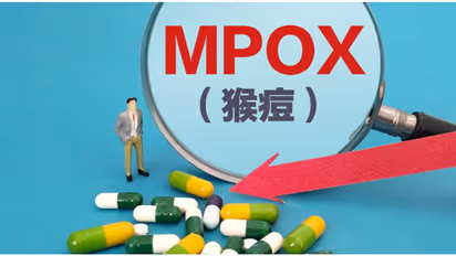 ഇത് രണ്ടാം തവണ! എംപോക്സ് വീണ്ടും ലോകത്തിന് ഭീഷണി, ആഗോള ആരോഗ്യ അടിയന്തരാവസ്ഥ പ്രഖ്യാപിച്ച് ലോകാരോഗ്യ സംഘടന