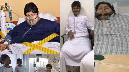 From 610 kg to 63 kg: How world's heaviest man lost over 500 kg with help of former Saudi King (WATCH)