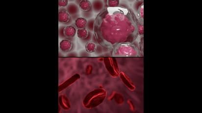 சாப்பிடும் போது இந்த அறிகுறிகள் இருந்தால் அசால்டா இருக்காதீங்க; புற்றுநோயாக இருக்கலாம்!