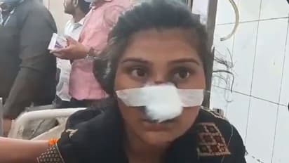 ರಾಖಿ ಕಟ್ಟಲು ತವರಿಗೆ ಹೊರಟ ಹೆಂಡತಿಯ ಮೂಗು ಕತ್ತರಿಸಿದ ಪಾಪಿ ಗಂಡ!