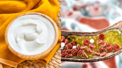 തൈര് കഴിക്കുന്നത് കൊളസ്ട്രോളിന്റെ അളവ് കൂട്ടുമോ?