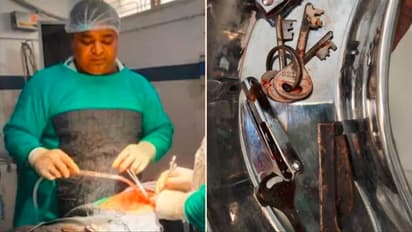 ಗೇಮ್ ಆಡಲು ಬಿಡದಕ್ಕೆ ಮನೆಯಲ್ಲಿದ್ದ ಚಾಕು ಕೀ ಬಂಚ್‌, ನೈಲ್ ಕಟ್ಟರ್ ನುಂಗಿದ ಯುವಕ