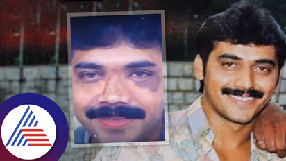 ನಟ ಶಶಿಕುಮಾರ್ ಮುಖ ಗುರುತೇ ಸಿಗದಷ್ಟು ಬದಲಾವಣೆ; ಆ ಆಕ್ಸಿಡೆಂಟ್ ನಂತರ ಏನಾಯ್ತು? 