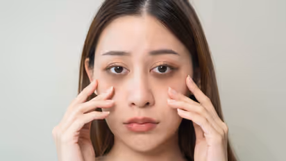 ഡാർക്ക് സർക്കിൾസ് മാറ്റാന് പരീക്ഷിക്കാം ഈ നാല് ടിപ്സ്