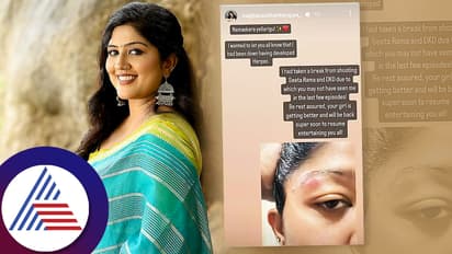 ಸೀತಾರಾಮ ಸೀರಿಯಲ್‌- ಡಾನ್ಸ್‌ ಕರ್ನಾಟಕ ಡಾನ್ಸ್‌ ಷೋನಿಂದ ಮೇಘನಾ ತುರ್ತು ಔಟ್‌! ಫ್ಯಾನ್ಸ್‌ ಶಾಕ್‌