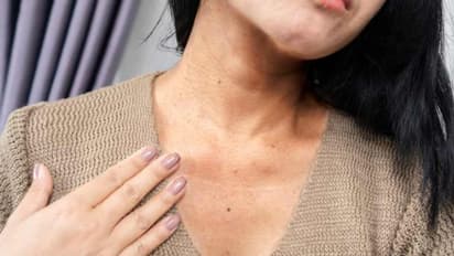 കഴുത്തിന് ചുറ്റുമുള്ള കറുത്ത പാടുകൾ മാറ്റാന്‍ ഇതാ ചില പൊടിക്കൈകള്‍