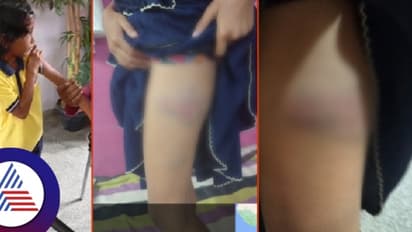 ಹೋಂ ವರ್ಕ್ ಮಾಡದ್ದಕ್ಕೆ ಮಗುವಿಗೆ ಮನಸೋಇಚ್ಛೆ ಥಳಿಸಿದ ಶಿಕ್ಷಕಿ!