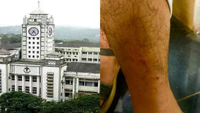 മെഡിക്കല് കോളേജില് ചികിത്സയിലുള്ള കുഞ്ഞിന്റെ അമ്മക്ക് പൂച്ചയുടെ കടിയേറ്റു, ചികിത്സ വൈകിയെന്ന് ആരോപണം