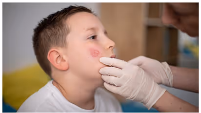 ഹോംവര്ക്ക് ചെയ്തില്ല, അധ്യാപകന് കുട്ടിയുടെ മുഖത്തടിച്ചു; കുട്ടിക്ക് പാണ്ടുരോഗം ബാധിച്ചെന്ന് അമ്മ