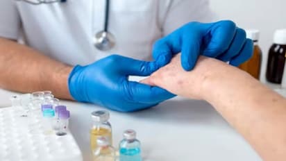 இந்தியாவில் ஒருவருக்கு குரங்கம்மை? தனிமைப்படுத்தப்பட்டு சிகிச்சை - சுகாதார அமைச்சகம் வெளியிட்ட அறிக்கை!