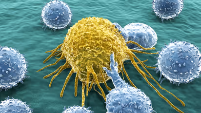 Appendix cancer awareness: Why early detection and lifestyle choices matter