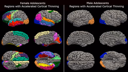 Pandemic fallout: Girls’ brains aged faster than boys' during Covid lockdown, new research reveals