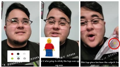 26 വർഷം മുമ്പ് മൂക്കില്‍ പോയ കളിപ്പാട്ട കഷ്ണം നിസാരമായി പുറത്തെടുത്ത അനുഭവം പങ്കുവച്ച് യുവാവ്; വീഡിയ വൈറൽ