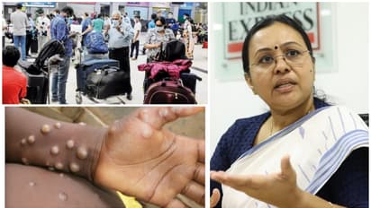 Mpox in Kerala: Health Minister Veena George urges people with symptoms to seek medical attention immediately
