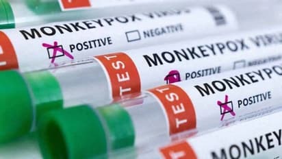 இந்தியாவில் நுழைந்த Mpox! அதன் அறிகுறிகள் என்னென்ன? எப்படி தடுப்பது?