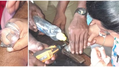 6 വയസുകാരിയുടെ ചൂണ്ടുവിരൽ ചില്ലുകുപ്പിയിൽ, ഏറെ പണിപ്പെട്ടിട്ടും പുറത്തെടുക്കാനായില്ല; രക്ഷക്കെത്തി ഫയർഫോഴ്സ്