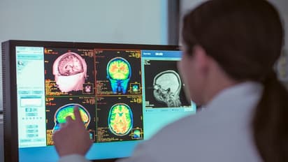 Brain damage may influence religious fundamentalism: Groundbreaking study reveals neural network behind belief