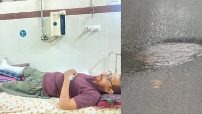 കോഴിക്കോട് ദേശീയപാതയിലെ കുഴിയിൽ വീണ് ബൈക്ക് യാത്രികന്‍റെ കാലൊടിഞ്ഞു