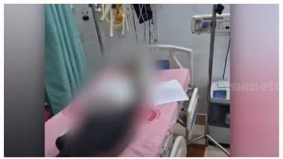 താമരശ്ശേരിയിൽ ബസിന്റെ ഹൈഡ്രോളിക് ഡോറിനിടയിൽപെട്ട് പ്ലസ് വൺ വിദ്യാർത്ഥിനിക്ക് പരിക്ക്