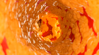 ചീത്ത കൊളസ്ട്രോളും അടിവയറിലെ കൊഴുപ്പും കുറയ്ക്കാന്‍ സഹായിക്കും ഈ അഞ്ച് എണ്ണകള്‍