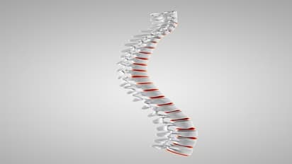 Post-Slip Disc Spine Surgery Recovery: Essential guidelines for a smooth healing process