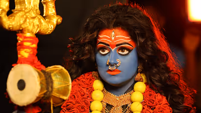 ಕೂದಲು ಉದುರುತ್ತಿತ್ತು, ಚರ್ಮದಲ್ಲೆಲ್ಲ ಗುಳ್ಳೆ.. ರಾಧಿಕಾ ಕುಮಾರಸ್ವಾಮಿಗೆ ಹೀಗ್ಯಾಕಾಯ್ತು?