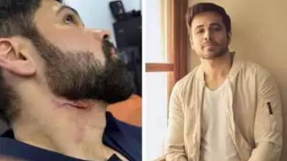 ഇമ്രാൻ ഹാഷ്‍മിക്ക് പരുക്കേറ്റു, ആക്ഷൻ രംഗത്തിന്റെ ചിത്രീകരണത്തിനിടെയാണ് അപകടം