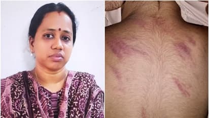 എൽകെജി വിദ്യാർത്ഥിയെ മർദ്ദിച്ച അധ്യാപിക സീതാലക്ഷ്മിയെ പിരിച്ചുവിട്ടു 