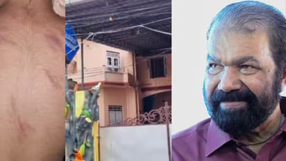 മട്ടാഞ്ചേരി കിസ്ഡ് പ്ലേ സ്കൂൾ അടച്ച് പൂട്ടാൻ നോട്ടീസ്' മൂന്നര വയസ്സുകാരന് ടീച്ചറുടെ മർദ്ദനം, ഇടപെട്ട് മന്ത്രി